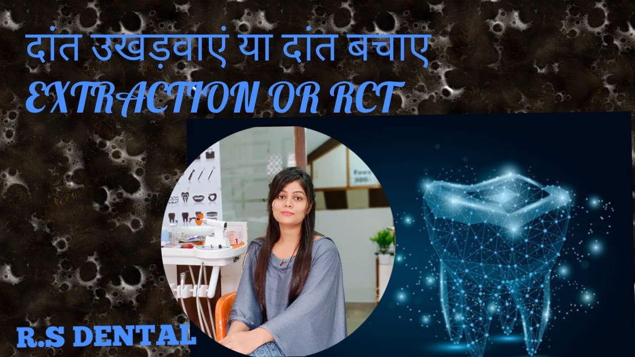 Dental Extraction or RCT (Root Canal Treatment) | दांत उखड़वाना या दांत ...