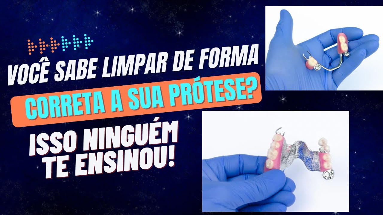 COMO LIMPAR SUA PRÓTESE DE GRAMPO