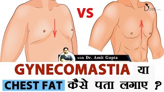Difference between Chest Fat and Gynecomastia? | Chest Fat vs Gyno | Chest Fat Kaise Kam Kare