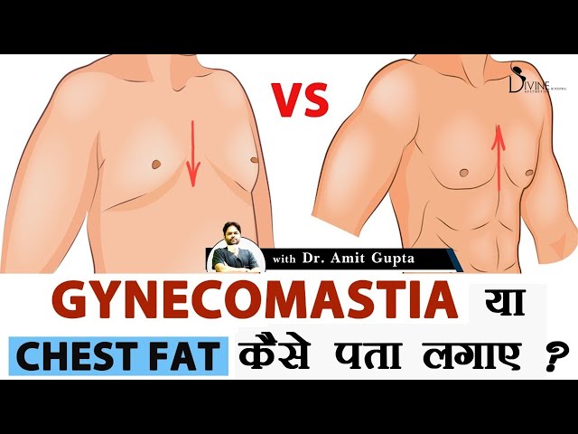 Difference Between Gynecomastia And Chest Fat - PharmEasy Blog