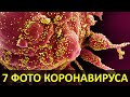 КОРОНАВИРУС ПОД МИКРОСКОПОМ | 7 ПОТ