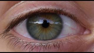eye PLOTAGRAPH