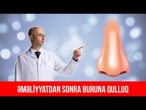 Uzman Dr Elnur Əkbərov l Əməliyyatdan sonra buruna qulluq