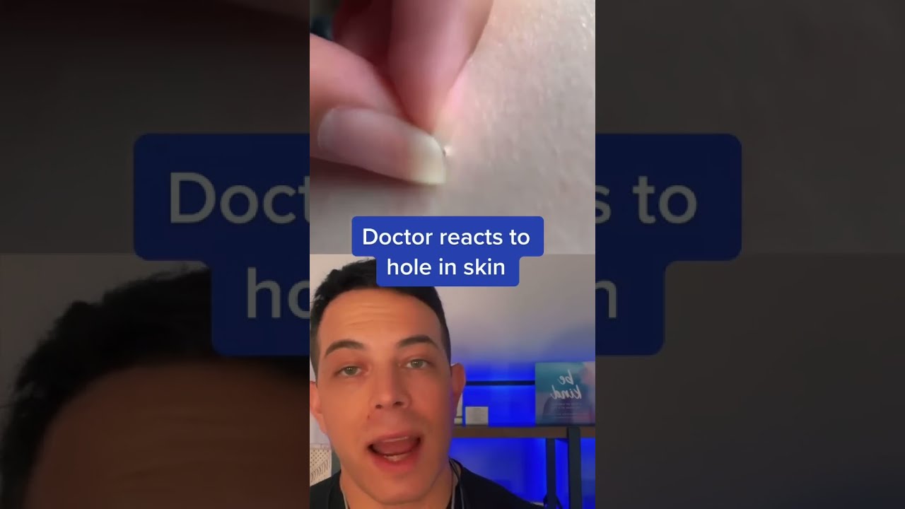 It Leaves A Hole In The Skin 208SkinDoc