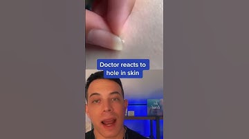 It leaves a hole in the skin? | 208SkinDoc