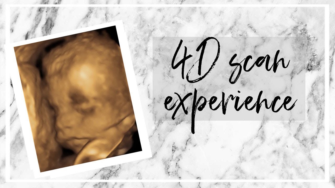 4D ULTRASOUND EXPERIENCE | WINDOW TO THE WOMB - YouTube