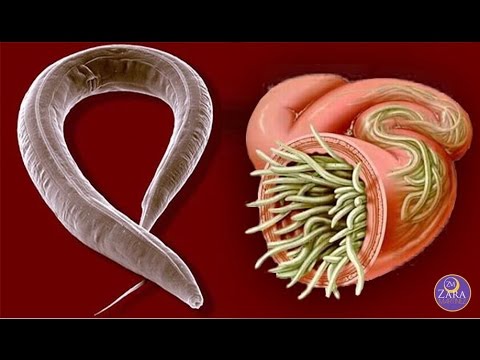Eliminar parasitos del intestino