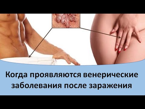 Видео: Является ли венерическое заболевание полностью излечимым?