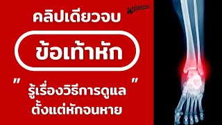 กระดูกข้อเท้าหัก - รู้เรื่องวิธีการดูแลตั้งแต่หักจนหาย (คลิปเดียวจบ)