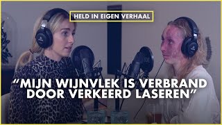 Wijnvlek, littekens, blind worden en uiterlijke acceptatie