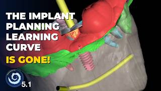 The Implant Planning Learning Curve Is Gone! Blue Sky Plan 5.1