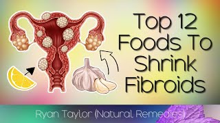 12 Foods That Shrink Fibroids (Naturally) screenshot 3