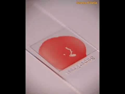 إذا لم يسبق لك أن شاهدت الدم تحت المجهر إليك هذا المقطع الممتع لعينة من الدم تحت المجهر