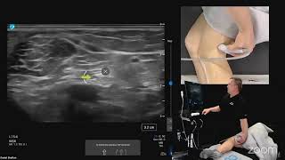 Ultrasound Evaluation Of The Medial And Lateral Knee