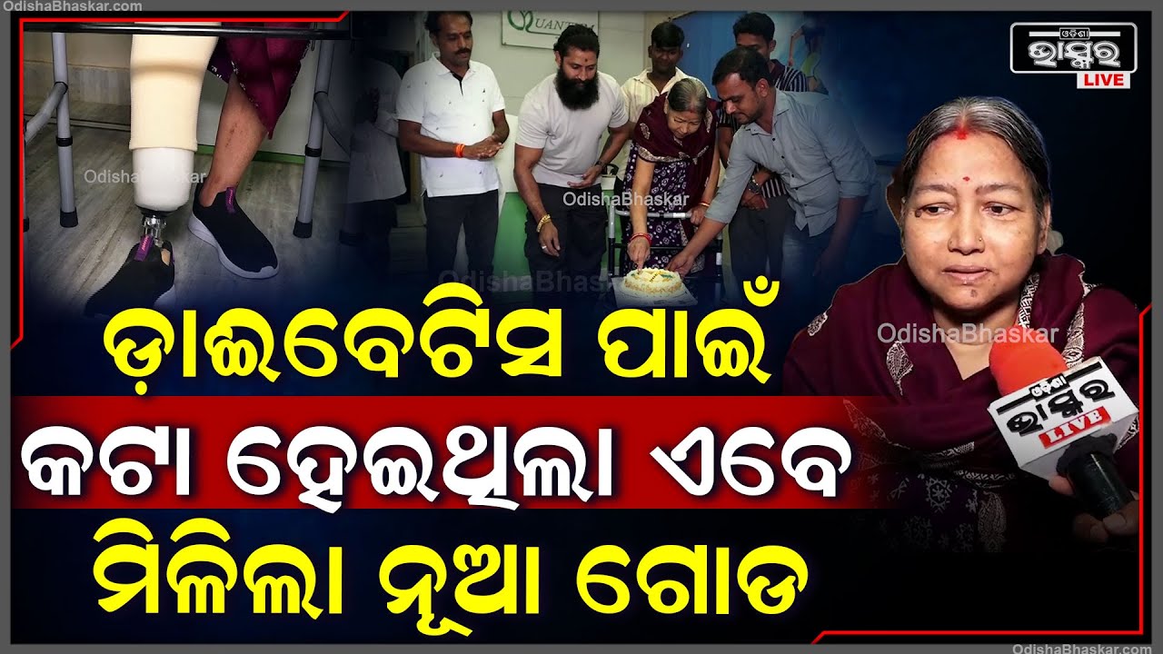 ଡାଇବେଟିସ ପାଇଁ ଏମିତି ଅବସ୍ଥା ହେଲା ଯେ ଗୋଡ କାଟିବାକୁ ପଡିଲା ..ହେଲେ ଏବେ ମିଳିଲା ନୂଆ ଗୋଡ