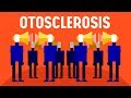 What is Otosclerosis?