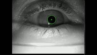 14. Real-time pupil detection on ExCuSe XIV