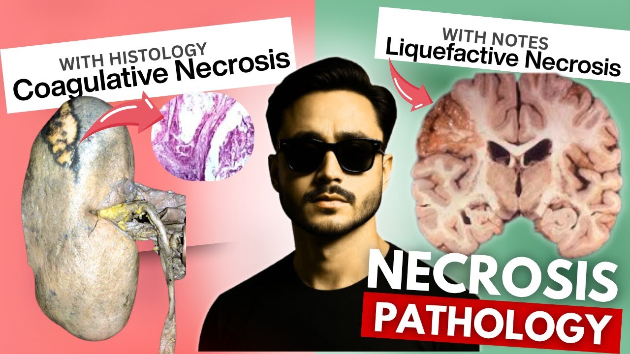 necrosis cell injury pathology | coagulative necrosis pathology | liquefactive necrosis pathology