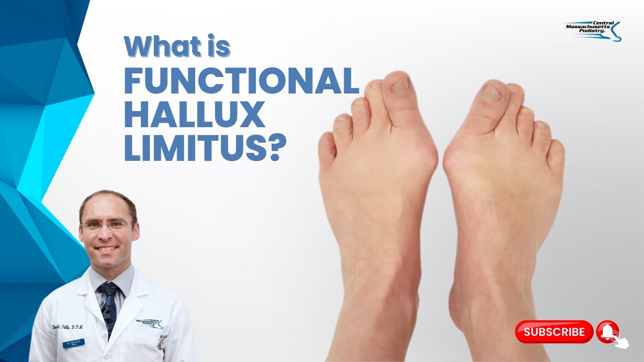 Функциональная ограниченность большого пальца стопы