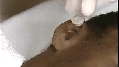 Nurses Video Handbook Lesson 519.AVI