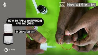 💅 How to apply antifungal nail lacquer to nail fungus?  |  by Dermatologist screenshot 1