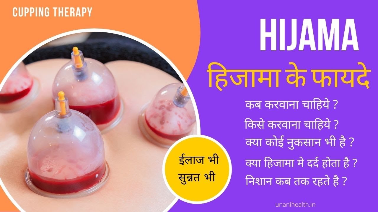 a kezelés a cukorbetegség hijama