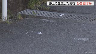 「けがをした時の記憶が無い」松阪の路上に血だらけの27歳男性 ひき逃げか