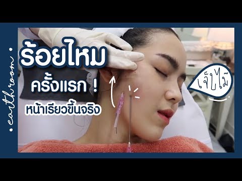 REVIEW : รีวิวร้อยไหม เห็นผลทันตา l earth room