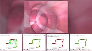 Famous Combining Deep Learning with Geometric Features for Image based Localization in the GI Tract Net Worth