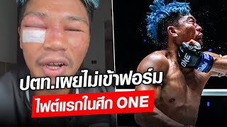 ปตท. อภิชาติฟาร์ม เปิดสภาพใบหน้าหลังศึก ONE ในไฟต์แรก : Khaosod - ข่าวสด