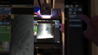 DRX Revolution - ImageView - Post Exam Review 1.3 - Image Post Processing - Abdo