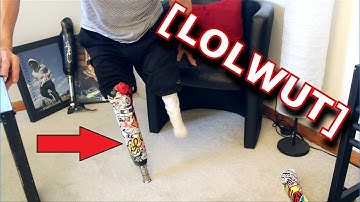 My CRAZY Custom Prosthetic Leg (Double Amputee)