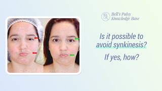 Is it possible to avoid synkinesis? If yes, how? - Bell&#39;s Palsy Knowledge Base