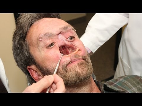 the-man-with-a-hole-in-his-face:-body-bizarre-episode-3