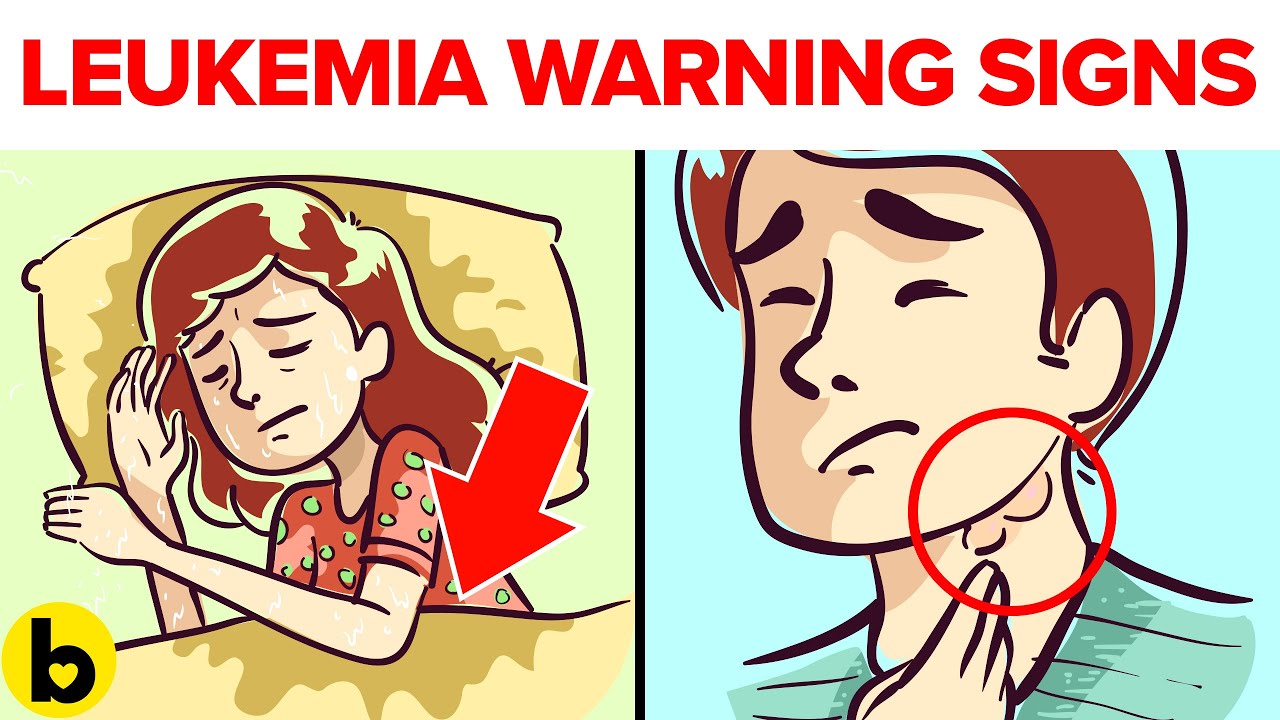 12 Warning Signs Of Leukemia You Should Be Aware Of YouTube