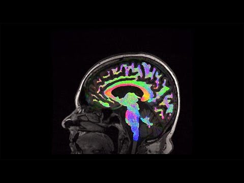 Vídeo: Montel Williams: Defensor De Lesiones Cerebrales Traumáticas