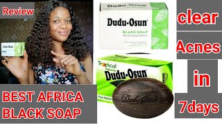 Honest review on DUDU OSUN HERBAL SOAP//clears hyperpigmentation in 7days.