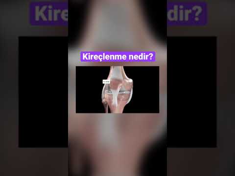 KİREÇLENME NEDİR?