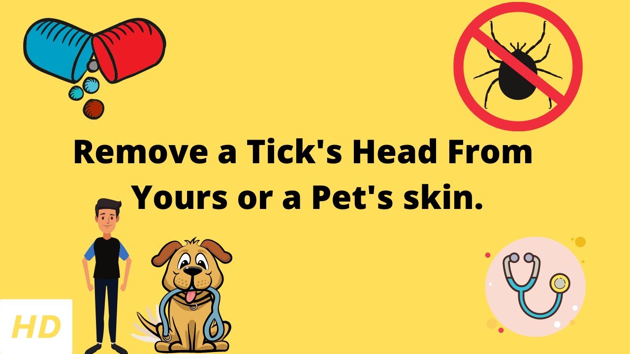 How Do You Know If A Tick'S Head Is Still In Your Skin?