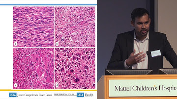 Sarcoma: Developing Drugs for Rare Disease - Arun Singh, MD | UCLA Cancer Care
