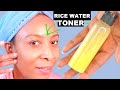 GET RID OF TRY SKIN, WRINKLES, AND LINES  GREEN TEA FACIAL TONER FOR A YOUTHFUL GLOW | Khichi Beauty