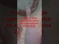 A doua zi după operație de varice cu spumă chinica 20-05-2026😇😅😁😉☺️😘