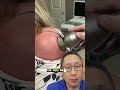 PBM Therapy for Arthritis Relief | Dr. Vidal Sheen | Sheen Vein Aesthetics and Functional Medicine