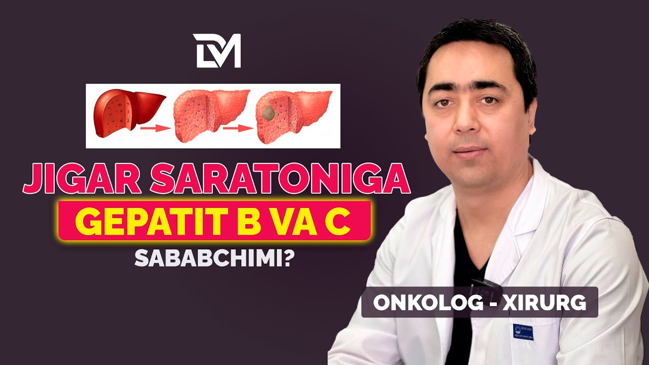 ЖИГАР САРАТОНИ, вирусли гепатит В ва С сабабчими?