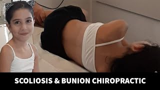 Bunion Ve Skoli̇oz Tedavi̇si̇ Hallux Valgus Chiropractor Evgeni Trigubov Genç Asmr Masajı