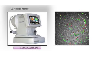 Classification and Segmentation of Dendritic cells by RSIP Vision
