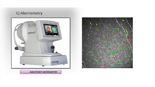Clification And Segmentation Of Dendritic Cells By Rsip Vision