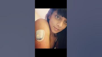 Omnipod insulin pump (Eros)