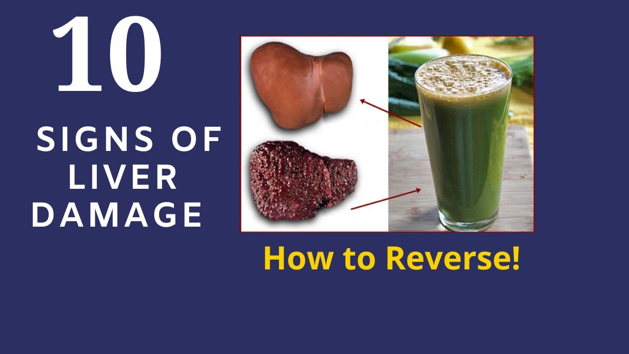 The Strange Signs of Liver Damage and How to Reverse! Natural Remedy. Puralean