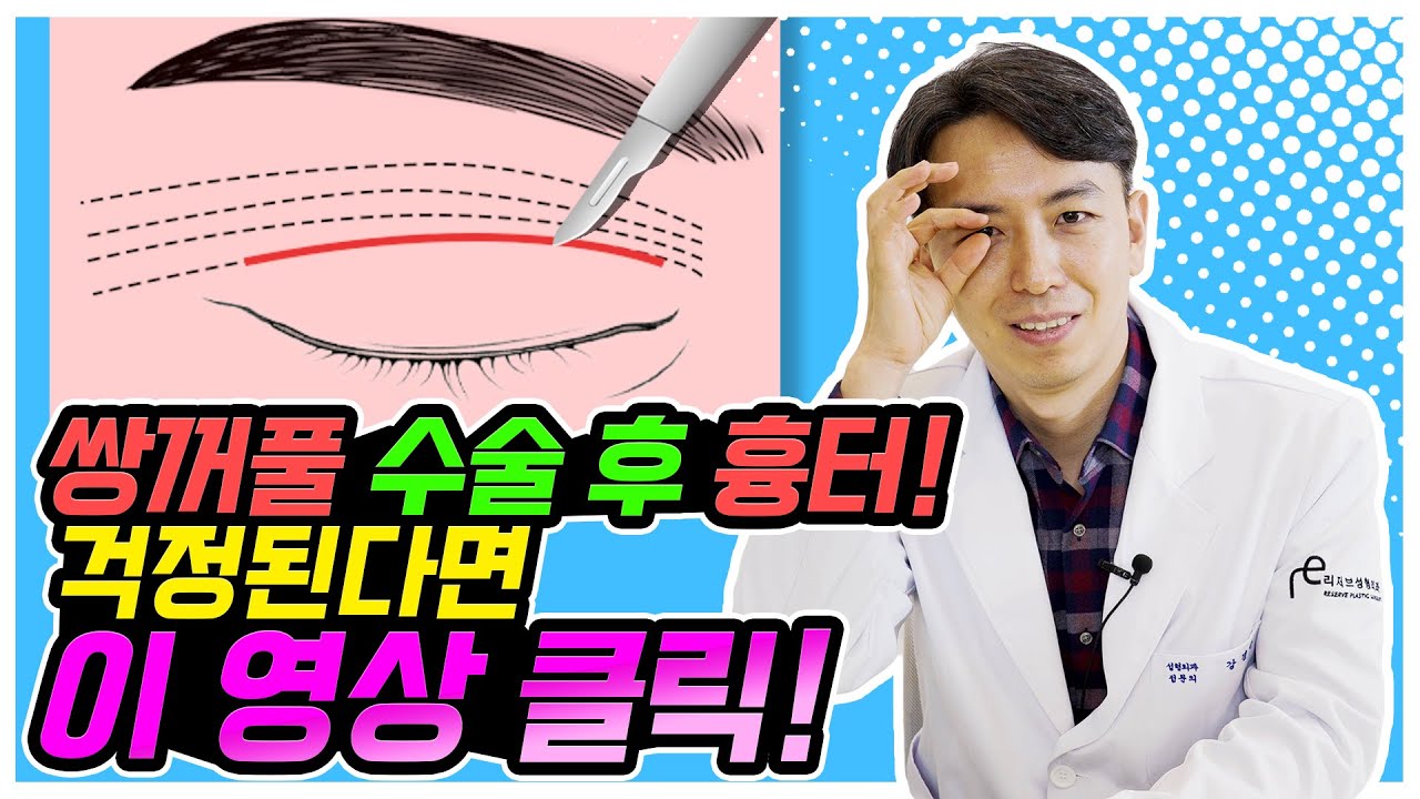 쌍꺼풀 흉터 때문에 수술을 망설이신다면 무조건 클릭하세요